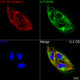 Anti-RPS6KB2 antibody (1-120) [S3MR] (STJ11102423) – Figure 1 of 1