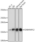 Anti-GABARAPL2 antibody (38-117) [S8MR] (STJ11102498) – Figure 1 of 1