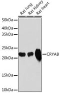 Anti-CRYAB antibody (76-175) [S1MR] (STJ11102511) – Figure 1 of 1