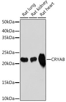 Anti-CRYAB antibody (76-175) [S1MR] (STJ11102511) – Figure 1 of 1