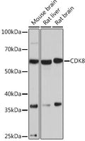 Anti-CDK8 antibody (1-100) [S7MR] (STJ11102517) – Figure 1 of 1