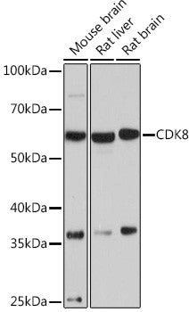 Anti-CDK8 antibody (1-100) [S7MR] (STJ11102517) – Figure 1 of 1