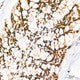 Anti-PIAS1/PIAS2 antibody (552-651) [S4MR] (STJ11102524) – Figure 1 of 1