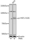 Anti-Phospho-HSF1-S326 antibody [S6MR] (STJ11102636) - Figure 1 of 1