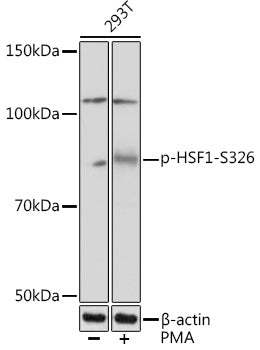 Anti-Phospho-HSF1-S326 antibody [S6MR] (STJ11102636) - Figure 1 of 1