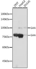 Anti-GAA antibody (100-200) [S6MR] (STJ11102966) – Figure 1 of 1