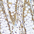 Anti-MAD2L1BP antibody (175-274) [S0MR] (STJ11103050) – Figure 1 of 1