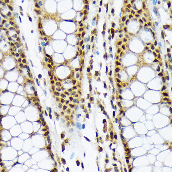 Anti-MAD2L1BP antibody (175-274) [S0MR] (STJ11103050) – Figure 1 of 1