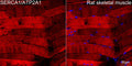 Anti-SERCA1/ATP2A1 antibody (900-1001) [S4MR] (STJ11103064) – Figure 1 of 1
