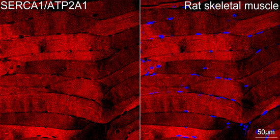 Anti-SERCA1/ATP2A1 antibody (900-1001) [S4MR] (STJ11103064) – Figure 1 of 1