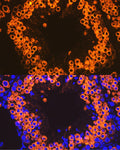 Anti-Calmegin antibody (180-350) [S7MR] (STJ11103067) – Figure 1 of 1