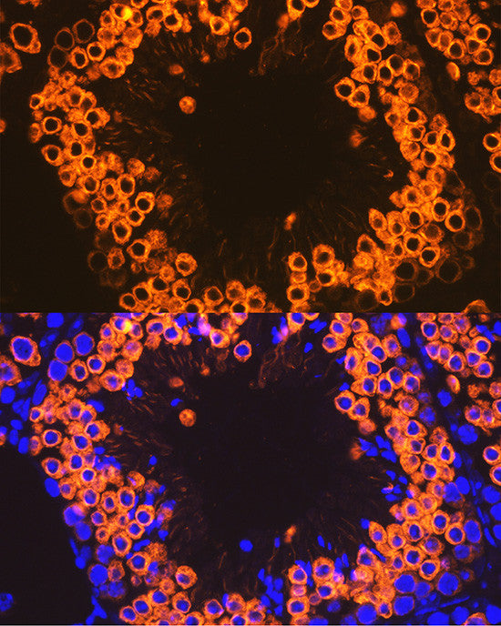 Anti-Calmegin antibody (180-350) [S7MR] (STJ11103067) – Figure 1 of 1