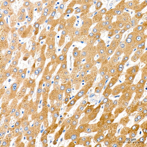Anti-Cytochrome P450 4A antibody (50-150) [S6MR] (STJ11103076) – Figure 1 of 1