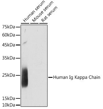Anti-Human Ig Kappa Chain antibody (1-107) [S3MR] (STJ11103093) – Figure 1 of 1