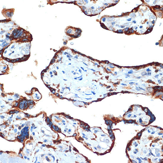 Anti-NAIP antibody (1-100) [S7MR] (STJ11103097) – Figure 1 of 1