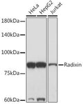 Anti-Radixin antibody (350-450) [S3MR] (STJ11103113) – Figure 1 of 1