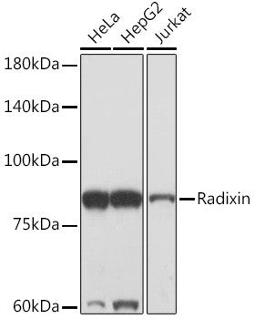 Anti-Radixin antibody (350-450) [S3MR] (STJ11103113) – Figure 1 of 1