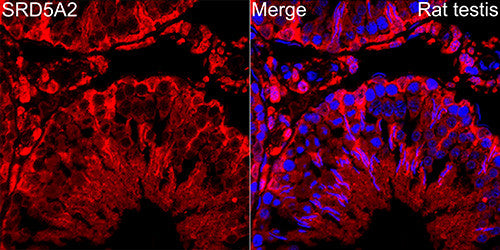 Anti-SRD5A2 antibody (1-100) [S8MR] (STJ11103118) – Figure 1 of 1