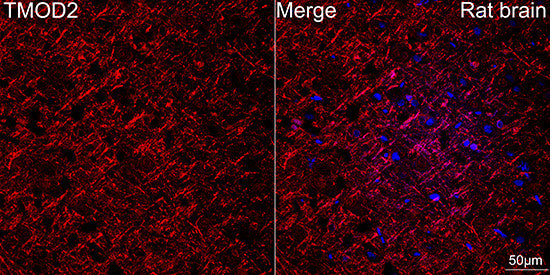 Anti-TMOD2 antibody (1-100) [S3MR] (STJ11103123) – Figure 1 of 1