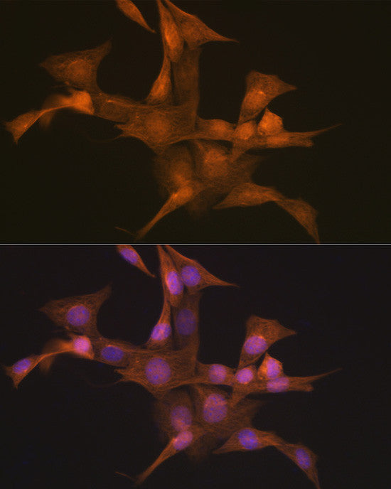 Anti-Nesprin 1 antibody (8200-8400) [S0MR] (STJ11103130) – Figure 1 of 1