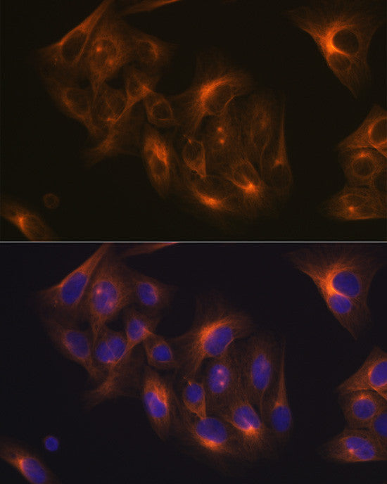 Anti-Tubulin beta-1 chain antibody (352-451) [S7MR] (STJ11103147) – Figure 1 of 1