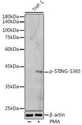 Anti-Phospho-STING-S365 antibody (STJ11103737) – Figure 1 of 1