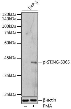 Anti-Phospho-STING-S365 antibody (STJ11103737) – Figure 1 of 1