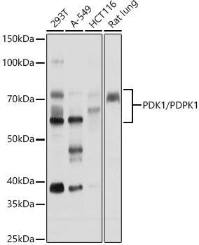 Anti-PDPK1 antibody (409-556) (STJ11104559) – Figure 1 of 1