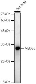 Anti-MYD88 antibody (50-150) [S4598RM] (STJ11104598) – Figure 1 of 1