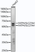 Anti-SLC27A4 antibody (43-237) [S4621RM] (STJ11104621) – Figure 1 of 1