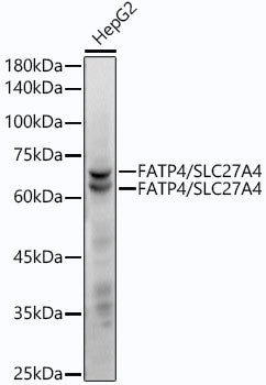 Anti-SLC27A4 antibody (43-237) [S4621RM] (STJ11104621) – Figure 1 of 1