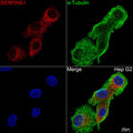 Anti-SERPINA1 antibody (25-418) [S4624RM] (STJ11104624) – Figure 1 of 1