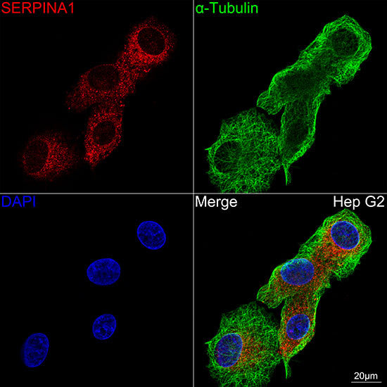 Anti-SERPINA1 antibody (25-418) [S4624RM] (STJ11104624) – Figure 1 of 1