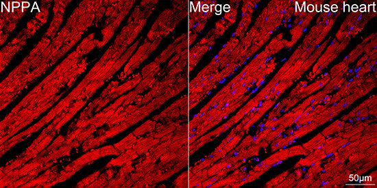 Anti-NPPA antibody (1-100) [S4694RM] (STJ11104694) – Figure 1 of 1