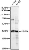 Anti-PPM1A antibody (1-382) [S4695RM] (STJ11104695) – Figure 1 of 1