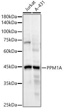 Anti-PPM1A antibody (1-382) [S4695RM] (STJ11104695) – Figure 1 of 1