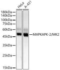Anti-MAPKAPK2 antibody (300-400) [S4747RM] (STJ11104747) – Figure 1 of 1