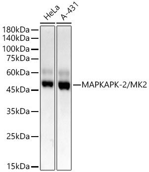 Anti-MAPKAPK2 antibody (300-400) [S4747RM] (STJ11104747) – Figure 1 of 1