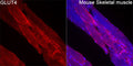 Anti-SLC2A4 antibody (210-310) (STJ11105583) – Figure 1 of 1