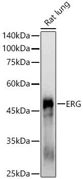 Anti-ERG antibody (1-100 aa) [SRM5072] (STJ11106848) – Figure 1 of 1