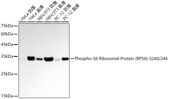 Anti-Phospho-S6 Ribosomal Protein-S240/244 antibody [SRM5547] (STJ11107738) – Figure 1 of 1