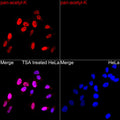 Anti-pan Kac antibody (STJ111149) – Figure 1 of 1