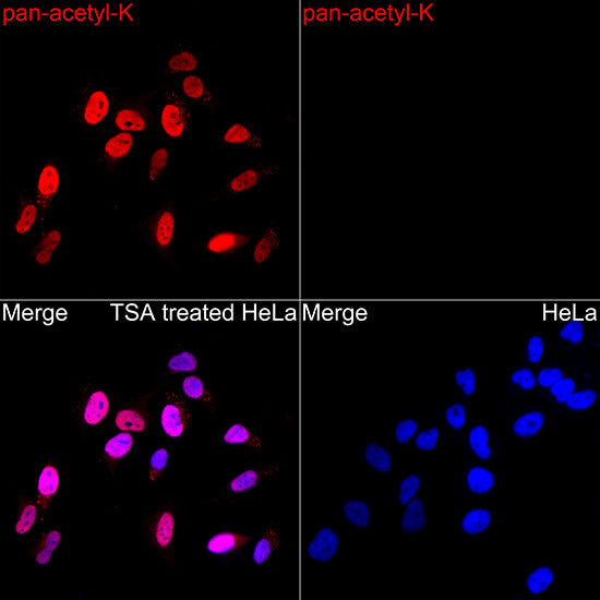 Anti-pan Kac antibody (STJ111149) – Figure 1 of 1