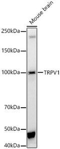 Anti-TRPV1 antibody (725-839) (STJ111299) – Figure 1 of 1