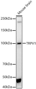 Anti-TRPV1 antibody (725-839) (STJ111299) – Figure 1 of 1