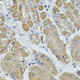 Anti-TRPA1 antibody (900-1000) (STJ111303) – Figure 1 of 1