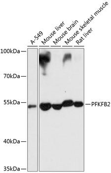 Anti-PFKFB2 antibody (446-505) (STJ111650) – Figure 1 of 1