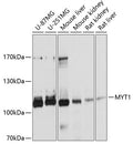 Anti-MYT1 antibody (650-820) (STJ112720) – Figure 1 of 1