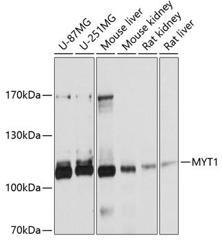 Anti-MYT1 antibody (650-820) (STJ112720) – Figure 1 of 1