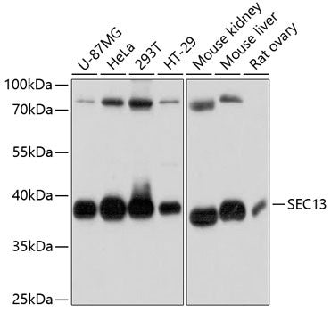 Anti-SEC13 antibody (1-322) (STJ113218) – Figure 1 of 1